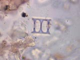 Diatom, Aulacoseira (Melosira)